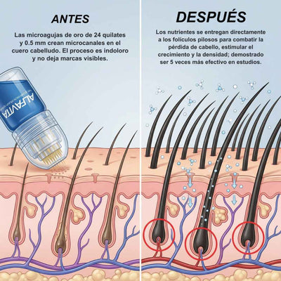 El sistema completo para la caída de cabello en hombres
