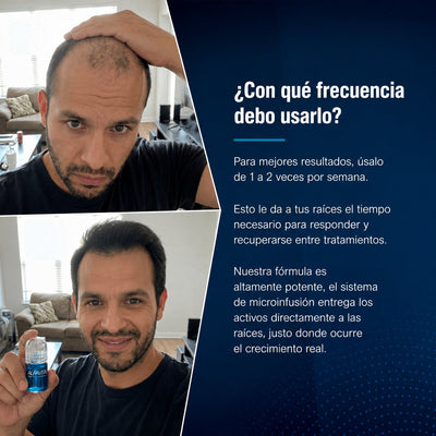 Alfavita™ Sistema Regeneración Capilar (2 meses)